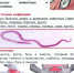 Трихинеллез - опасное заболевание! - Гатчинский район